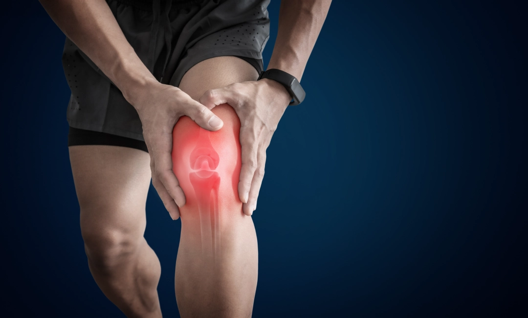 Osteoarthritis of the Knee, How common is osteoarthritis of the knee?, Who is affected by osteoarthritis of the knee?, symptoms of osteoarthritis in the knee