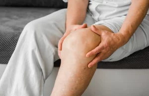 Osteoarthritis of the Knee, How common is osteoarthritis of the knee?, Who is affected by osteoarthritis of the knee?, symptoms of osteoarthritis in the knee